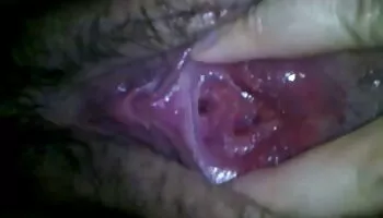 Cabeza afeitada